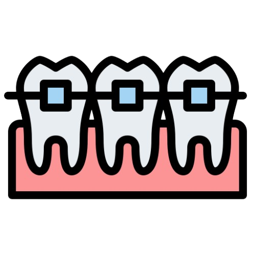🦷 Dental Implants
